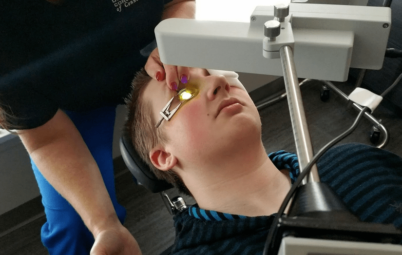 Retikulation eliminiert Keratokonus zu Beginn seiner Entwicklung effektiv